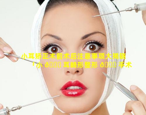 小耳矫正术前术后注意事项大揭晓「小 🐅 耳畸形整形 🐎 手术全过程」